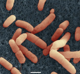 Poepbacterie E. coli O104 H4 in kiemgroente (fenegriek)